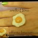 Anello uovo